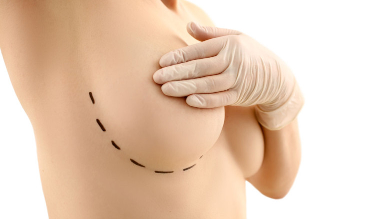 Understanding the Different Types of Breast Augmentation Procedures