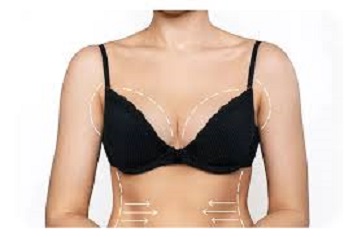 Breast reduction in Abu Dhabi