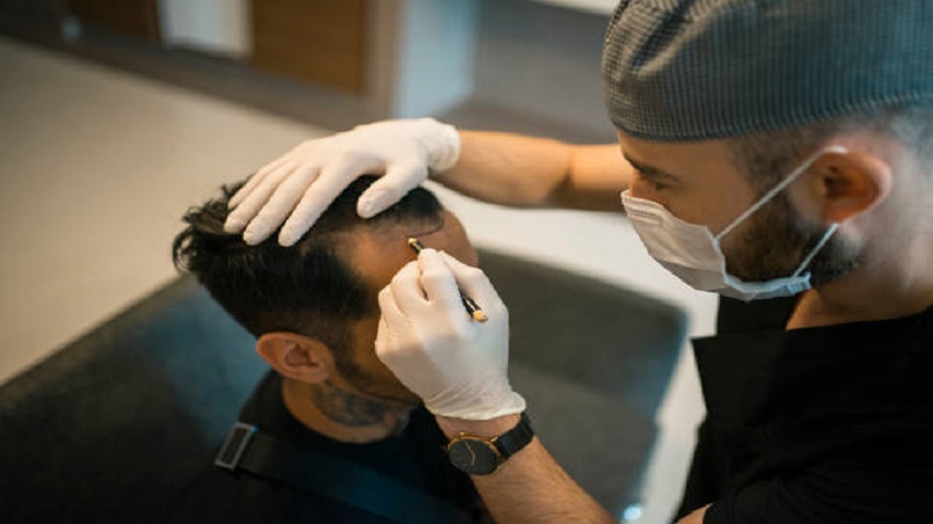 Hair Transplant in Abu Dhabi