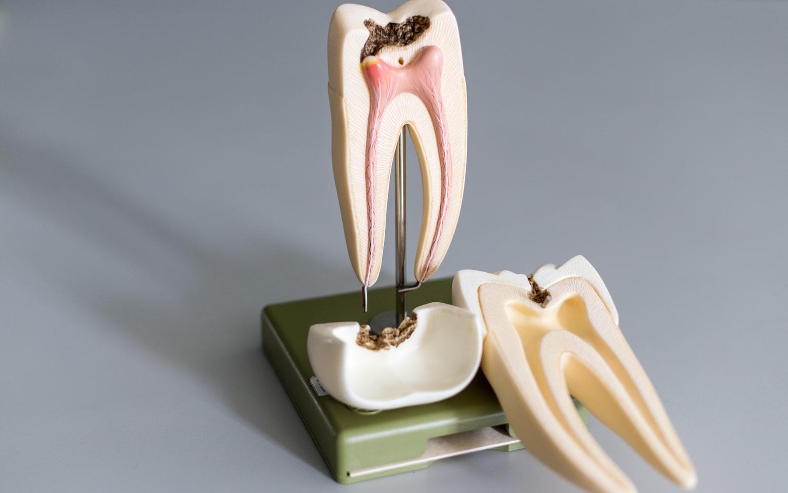 Root Canal Obturation