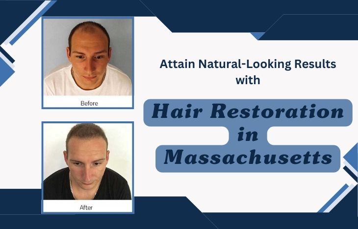 Attain-Natural-Looking-Results-with-Hair-Restoration-in-Massachusetts