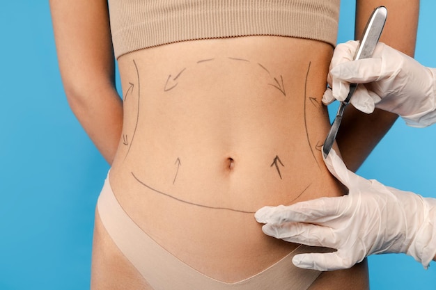 Is Mini Abdominoplasty Worth the Investment?