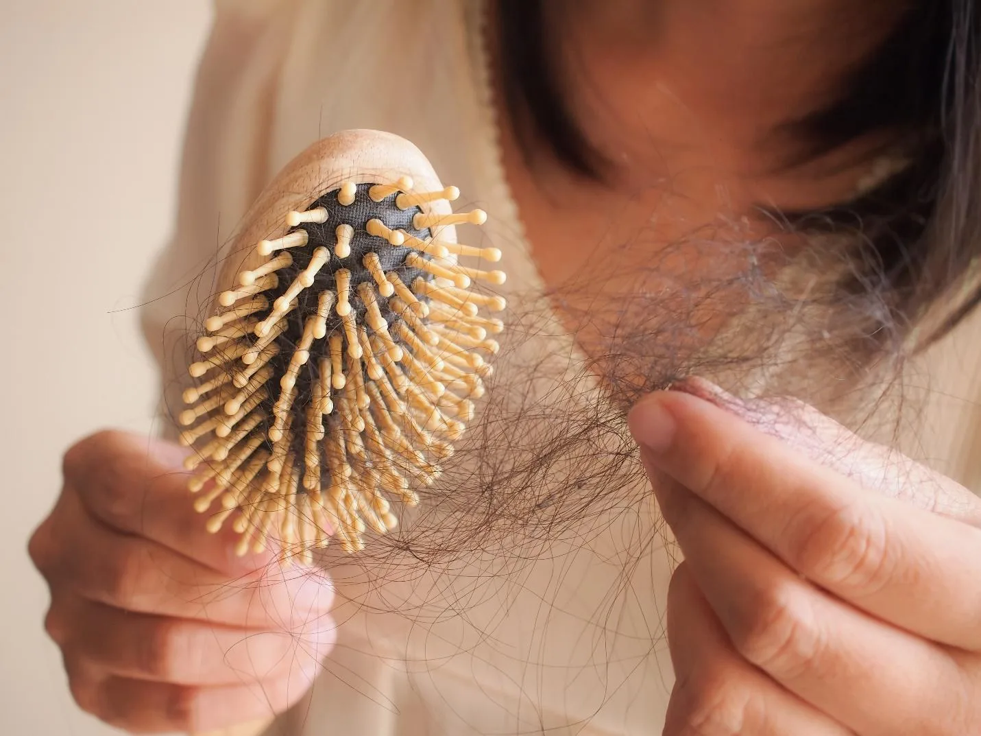 Hair Loss