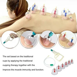 best cupping set