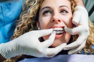 invisalign Widnes