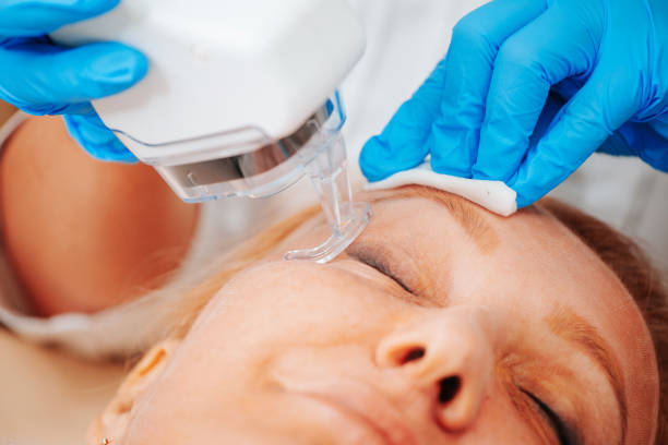 Does Fractional CO2 Laser Tighten Skin?