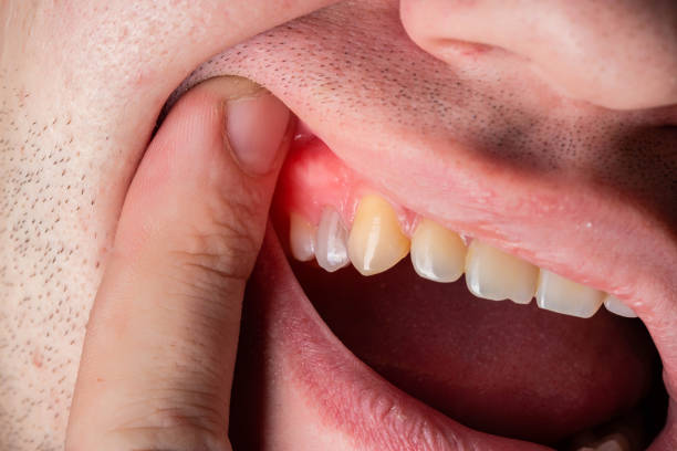 How to Handle Tooth Pain Before Seeing a Dentist