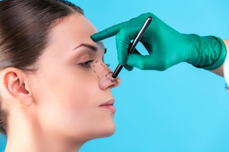 How Rhinoplasty Surgery Can Transform Your Facial Looks
