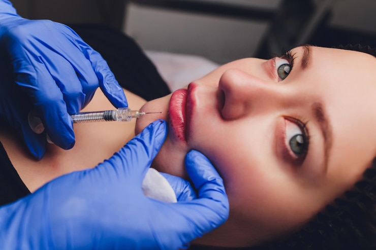Russian Lip Fillers: A Revolutionary Lip Enhancement Technique