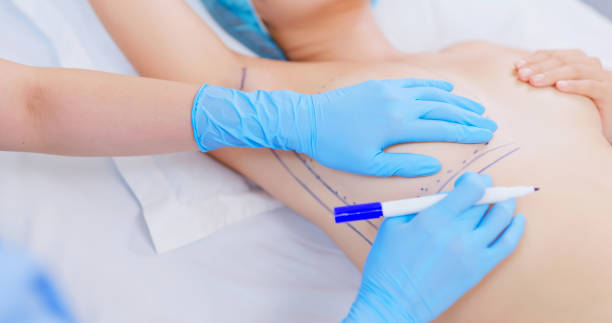 Unleash Your Confidence with Breast Augmentation Surgery