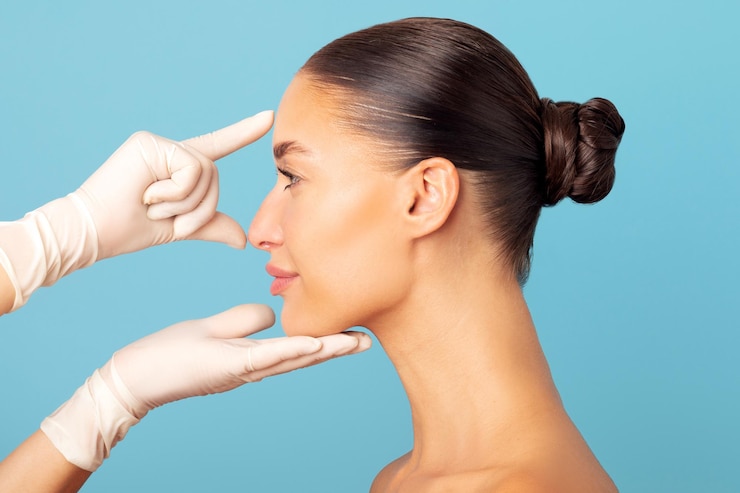 What to Expect After Rhinoplasty Surgery?
