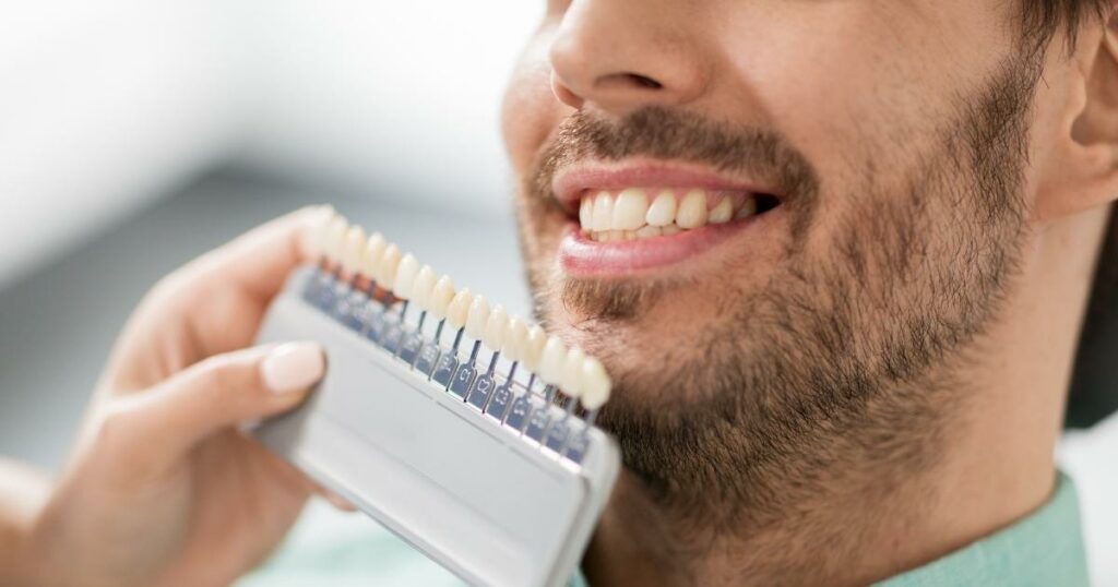 Veneers Dubai