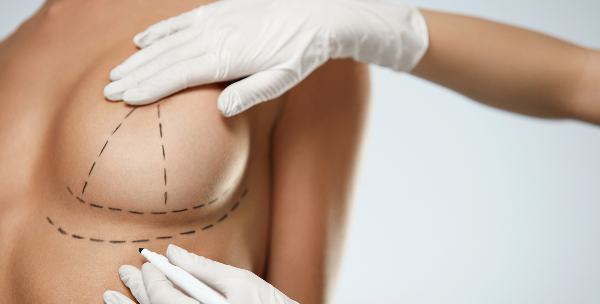 Breast Augmentation in Riyadh | Enhance Shape & Confidence 2025