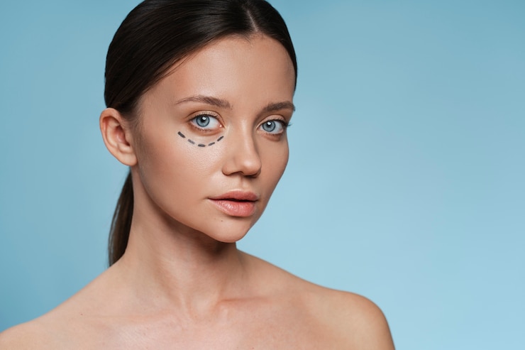 Can Blepharoplasty Surgery Refresh Your Appearance?