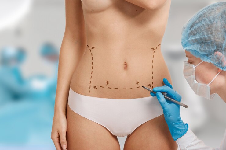 Discover the Power of Mini Abdominoplasty Surgery