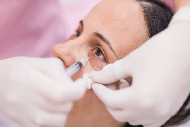 How Effective Are Dermal Fillers Injections?