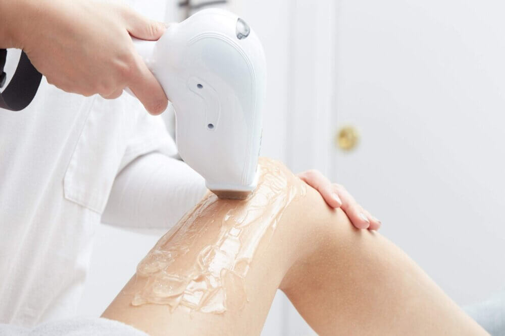 Laser hair removal in Islamabad