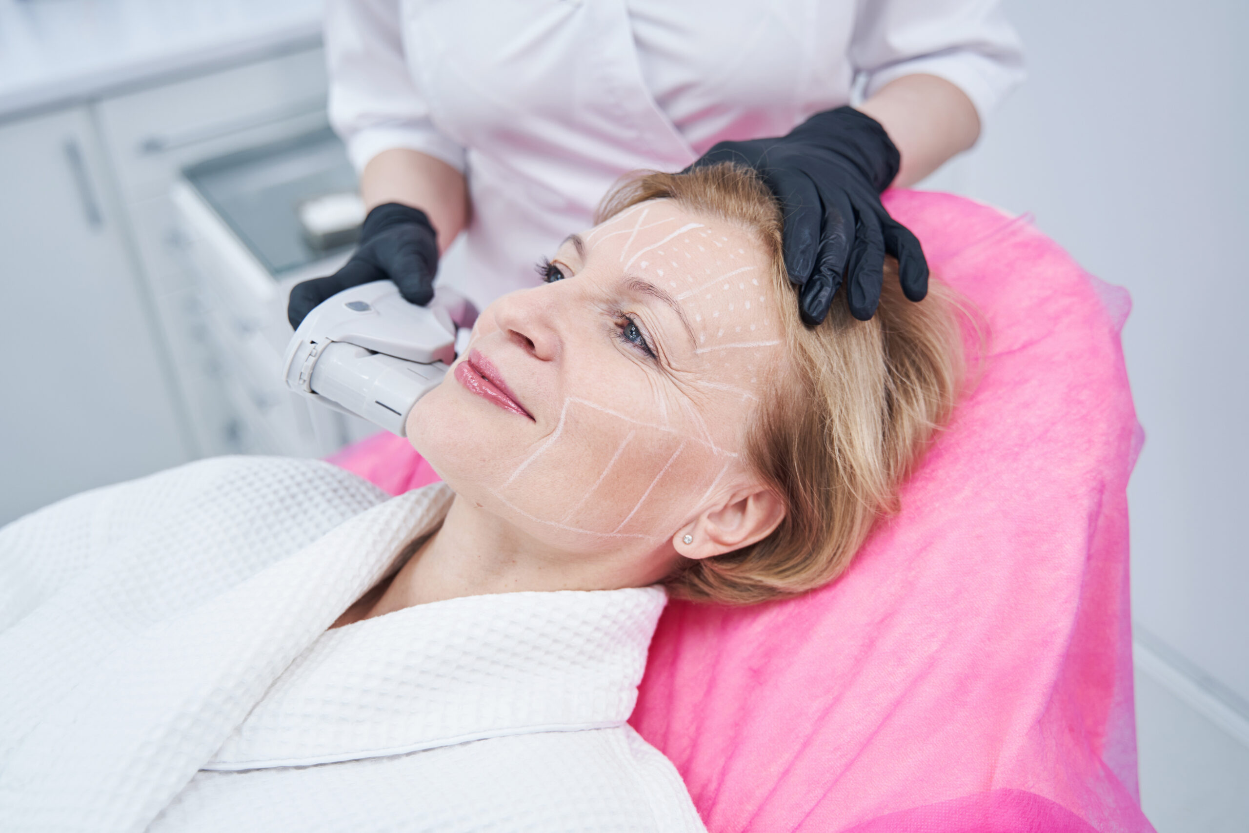 tighten skin with HIFU Treatment in Dubai