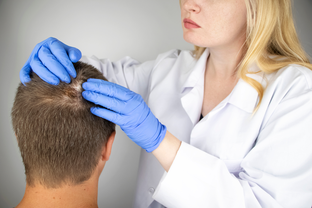 Androgenetic Alopecia