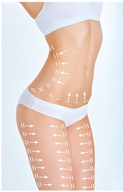 Body Sculpting in Riyadh