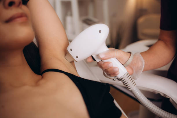 Best Laser Tech for Hair Removal Riyadh