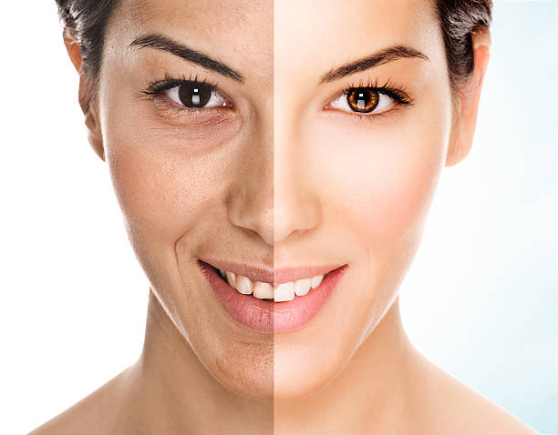 Facelift in Riyadh