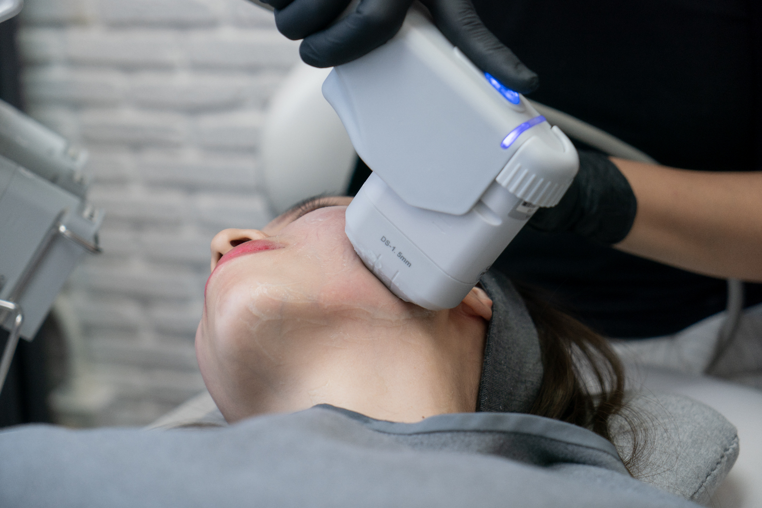 tighten skin with HIFU Treatment in Dubai
