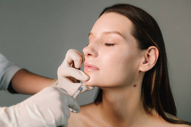 Is Jawline Filler Right for a Slimmer Face?