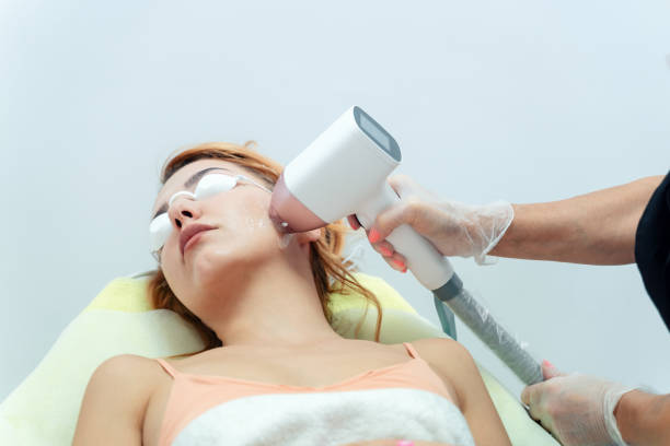 Laser Hair Removal in Riyadh