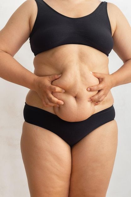 Liposuction in Riyadh