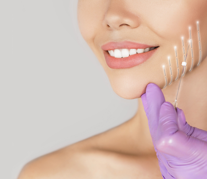 Thread facelift without surgery Islamabad