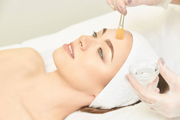 What to Expect from a Chemical Peels Treatment?