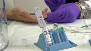 Hepatitis C Test in Dubai