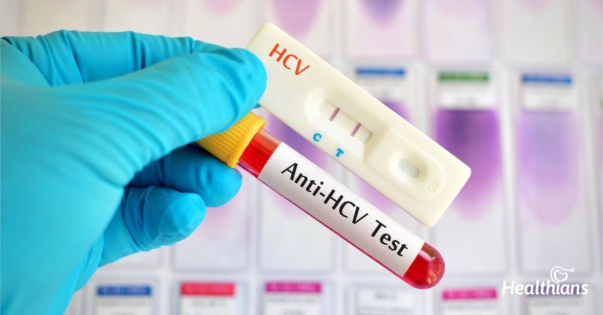 Hepatitis C Test in Dubai