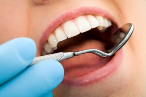 Tooth Filling Cost in Dubai