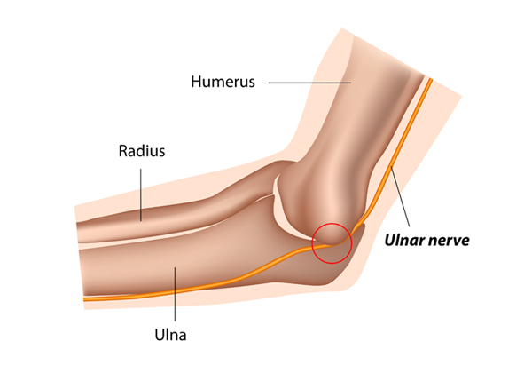 Ulnar Nerve Surgery
