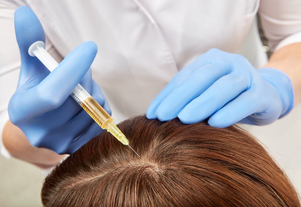 Best PRP Hair Treatment in Dubai