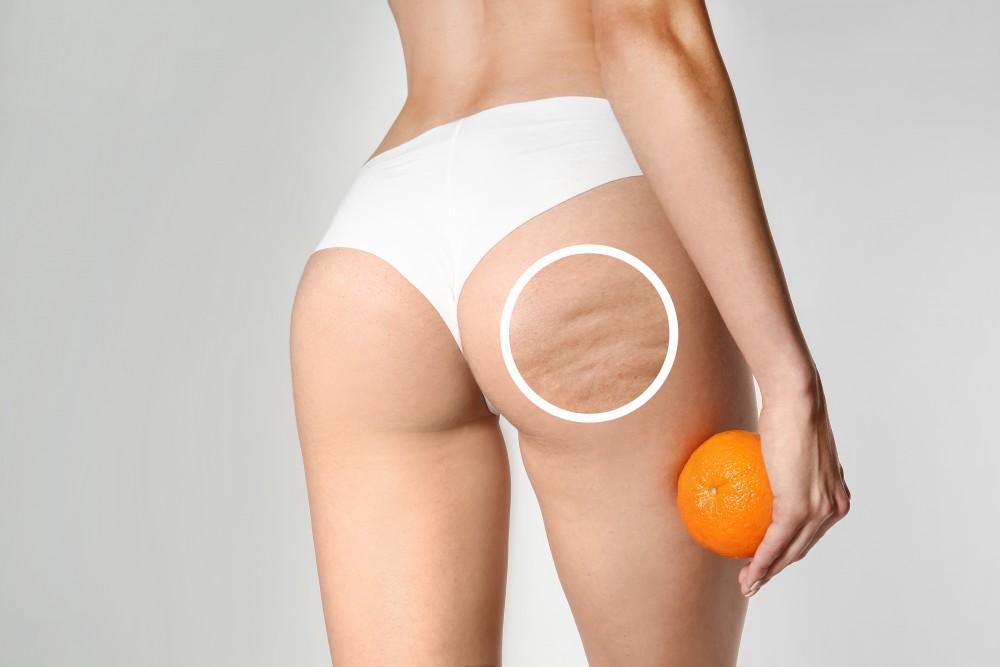 butt and body fillers in Dubai