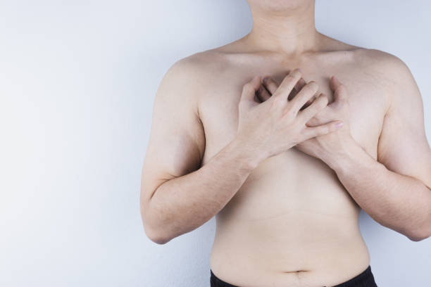 Gynecomastia Surgery in Riyadh