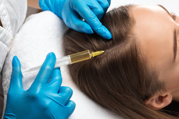 How PRP Hair Treatment habi Helps Regrowth