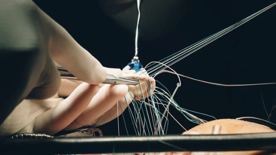 Minimally Invasive Cardiac Surgery