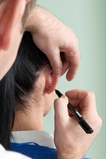 Otoplasty in Riyadh or Ear Reshaping in Riyadh