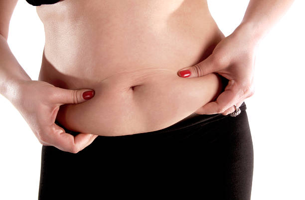 Tummy Tuck in Riyadh