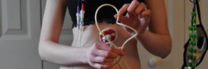 Tube Feeding at home in Dubai