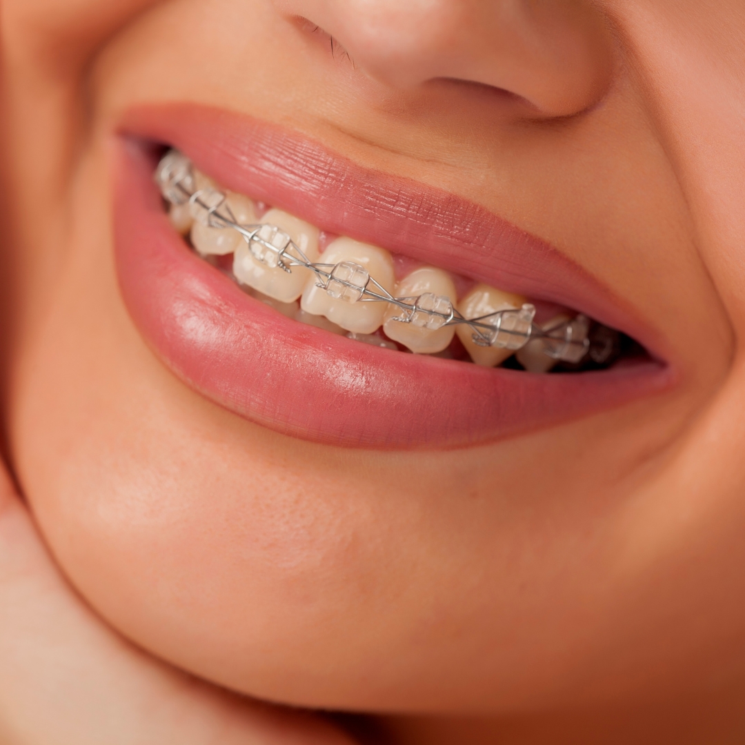 orthodontist cost for braces