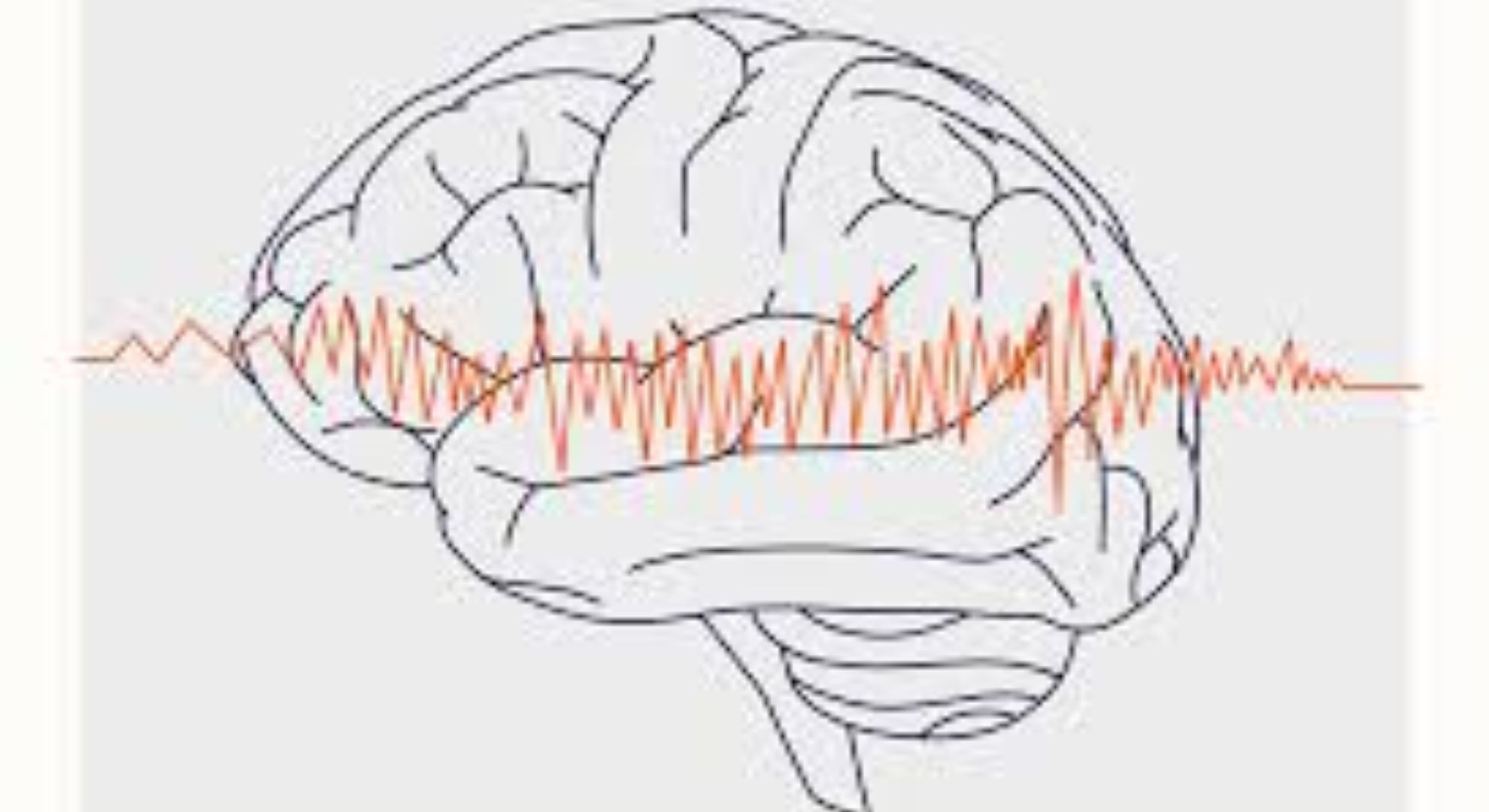 seizures image