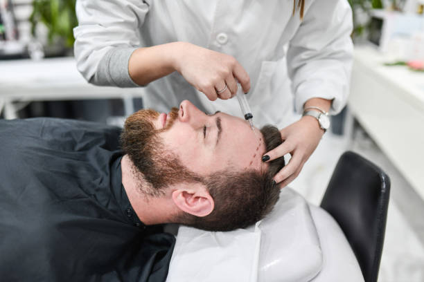 زراعة الشعر في الرياض