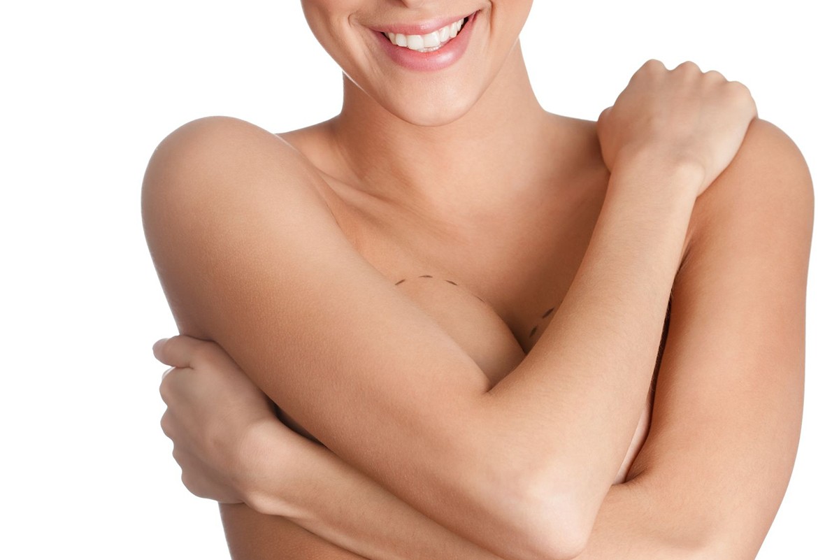 Breast Augmentation