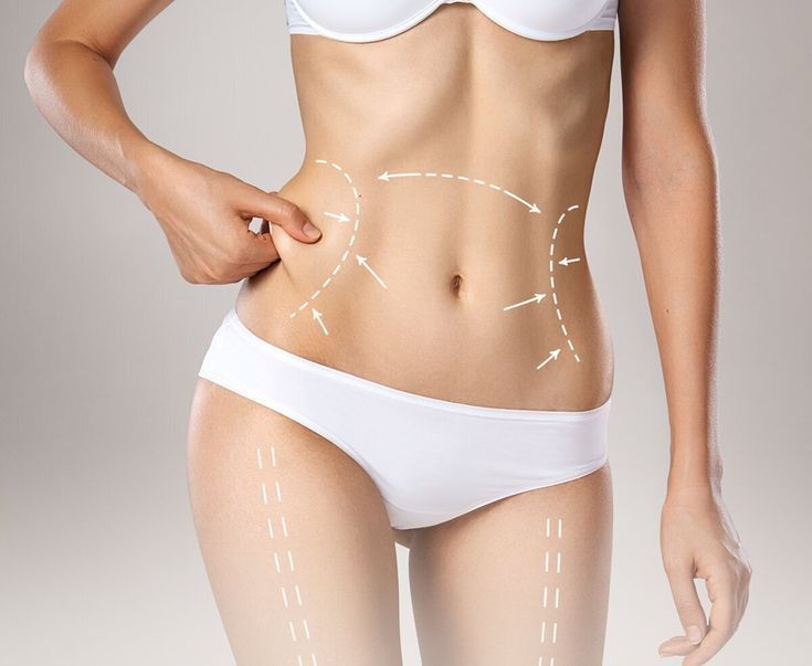 Liposuction in Riyadh