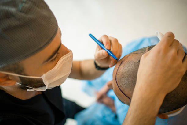 Hair transplant in islamabad